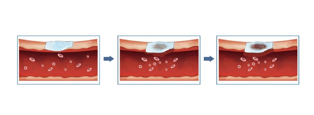 hemostatic-gauze-pad hemostatic-gauze-pad